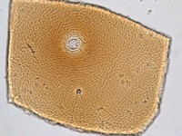 impronta perineale di Globodera rostochiensis