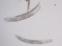 Fig. 2 Larve di Heterodera sp.