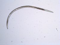 Fig. 4 Maschio di Heterodera sp.