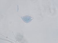Foto 3: zoosporangi di Phythophthora parasitica